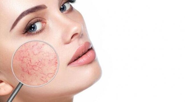 İlerleyen yaş cilt problemlerine sebep oluyor