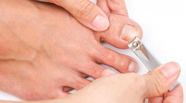 Tırnak batmasına dikkat