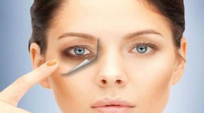 Göz altı morluklarına dikkat