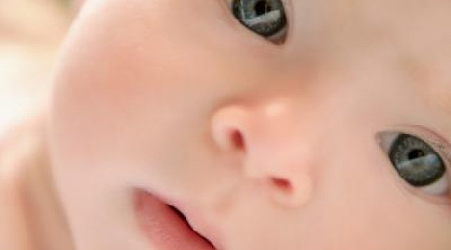 “Şaşılık genetik olabilir”