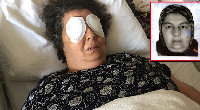 Şizofreni hastası kadın oda arkadaşının gözlerini oydu, Valilik 7 personeli açığa aldı.