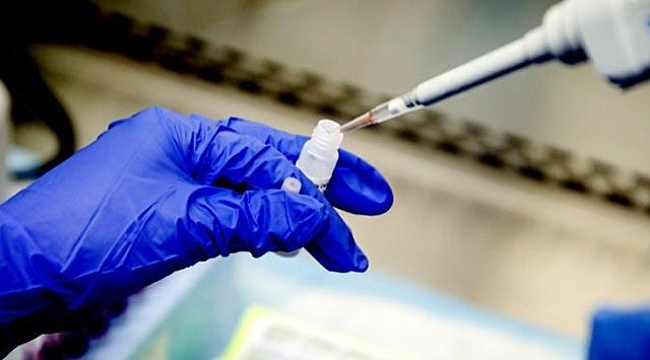 Koronavirüs aşısında ilk adım atıldı! Prof. Dr. Aykut Özkul Kovid-19'u izole etmeyi başardı.