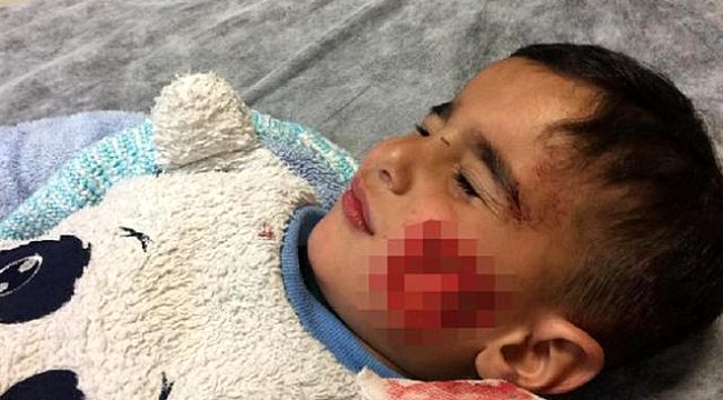 Şanlıurfa'da köpek saldırısına uğrayan küçük Davut, kurtarılamadı.