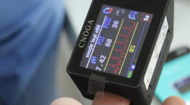 Koronavirüs hastalarına evden online takip: Kan aldırmaya gerek kalmayacak