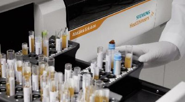Koronavirüse karşı bağışıklığın gücünü ölçen test kiti geliştirildi
