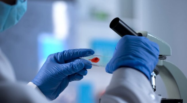 Bir ilk yaşandı: HIV&#039;den tamamen kurtuldu iddiası