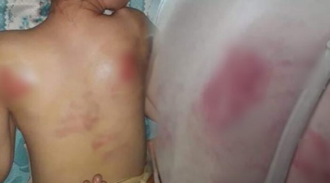 Tekirdağ&#039;da dehşet! Kızını İngiliz anahtarıyla dövdü