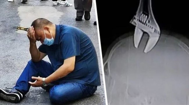 Yolda yürürken kafasına kurbağacık saplandı