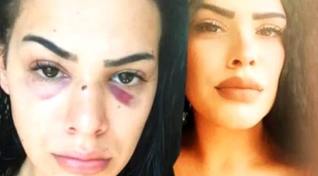 Bostancı&#039;da kendisini taciz etmeye çalışan iki kişiden kaçarken darbedilen kadının yardım çığlığı.