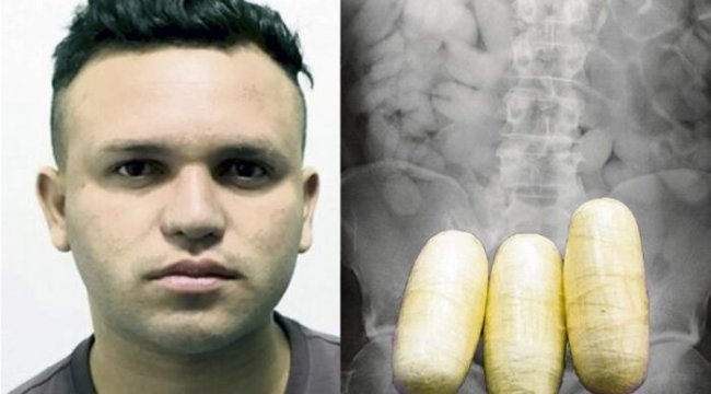 X-ray’de çıkan görüntüye kimse inanamadı! 99 poşet kokain çıktı!