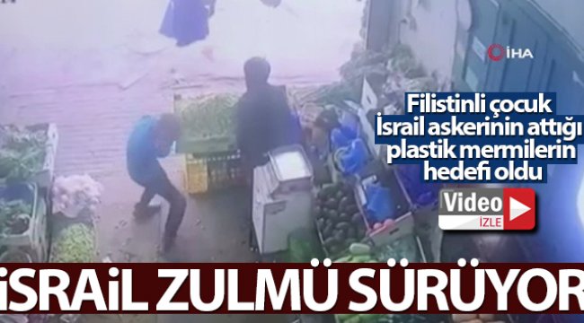 İsrail güçleri Batı Şeria'da Filistinli çocuğu plastik mermi ile gözünden vurdu