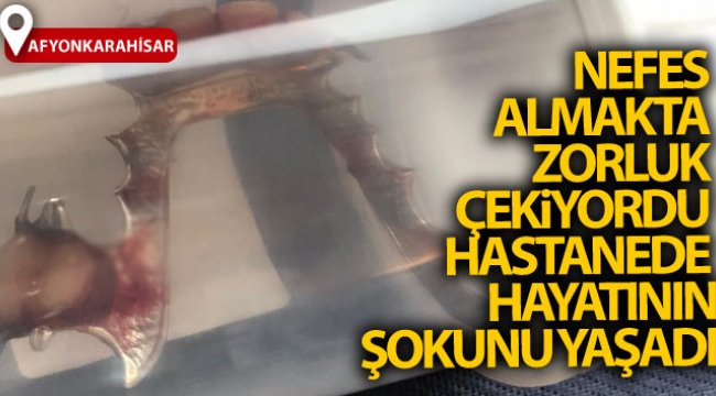 Nefes almakta zorluk çeken kadının boğazından bakın ne çıktı