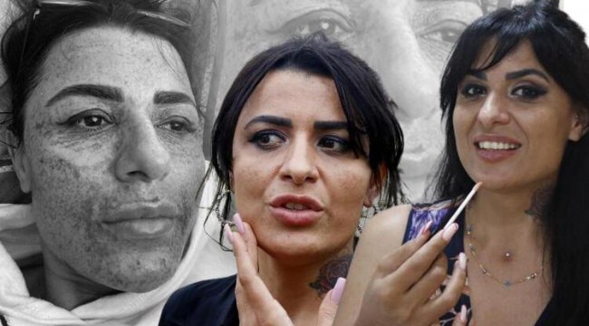 Antalya&#039;da gittiği güzellik salonunda kâbusu yaşamıştı... Bu kez iyi haber