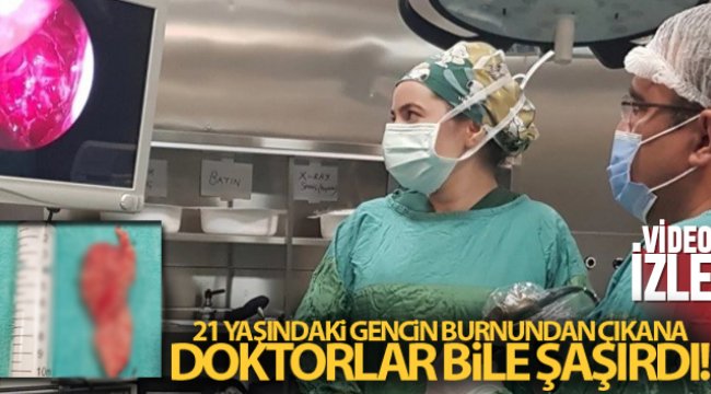 Nefes almakta güçlük çekiyordu burnundan 10 santimetre tümör alındı