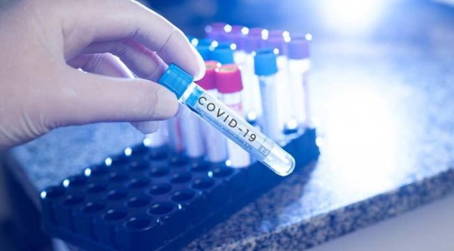 PCR testi zorunluluğu kimlere geldi? Öğretmenler, üniversite öğrencileri, uçak ve şehirler arası otobüs yolculuğu yapacaklar dikkat!