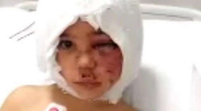 SON DAKİKA: Pitbull saldırısına uğrayan Asiye'nin son durumuna ilişkin açıklama