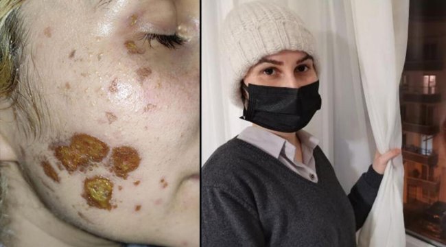 Adli tıp raporu açıklandı! Yüzündeki yaralar sabit iz niteliğinde