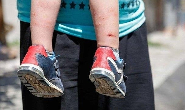 İzmir'de sivrisinek alarmı: Uzmanlar özellikle bu türe karşı hamileleri uyardı