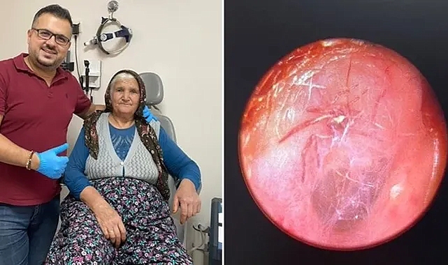 &#039;Hışırtı&#039; şikayetiyle gitti: Kulağından canlı örümcek çıktı!