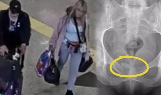 İzmir'de havalimanında vücutlarına gizledikleri uyuşturucuyla yakalanan 5 kişi yakalandı