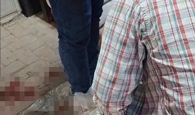 Aracı kurşunlanan vatandaş, şimdi de silahlı saldırıya uğradı