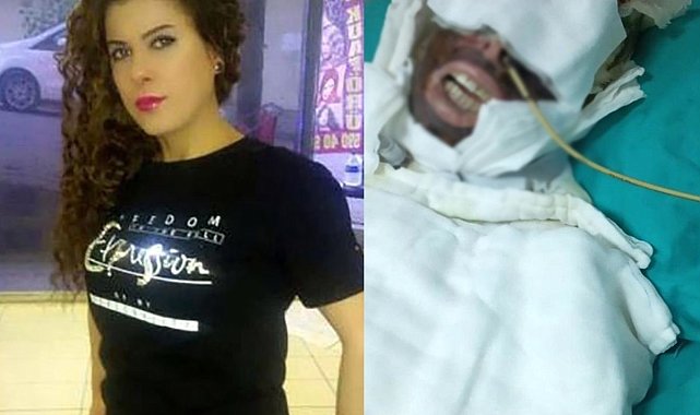 Avcılar'da eski sevgilisine kimyasal madde ile saldıran sanığın yargılanmasına devam edildi