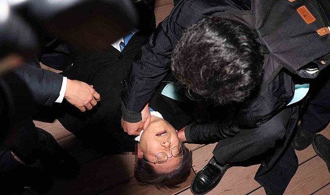 Güney Kore&#039;de boynundan bıçaklanan ana muhalefet lideri ameliyat oldu