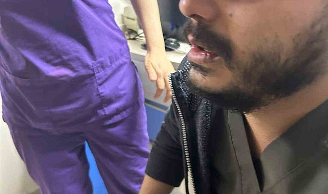 Gaziantep'te hasta yakınları tarafından darp edilen doktorun burnu kırıldı