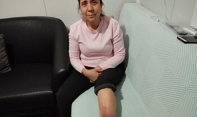 Köpek saldırısına uğrayan kadının bacağında yarık oluştu