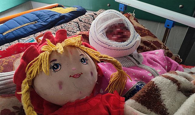 İsrail'in saldırılarında yüzü yanan 4 yaşındaki Seca, tedavi için bekliyor
