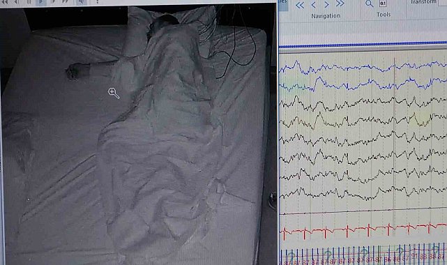 Klinik Nörofizyoloji Uzmanı Leba: "Uyku hastalığı kişinin ömrünü kısaltır"