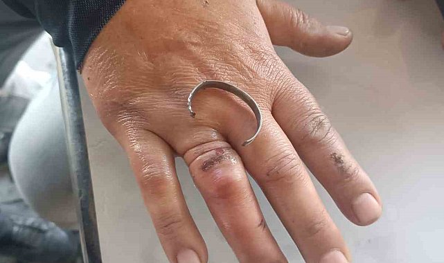 Parmağına sıkışan yüzüğü, itfaiye keserek çıkardı