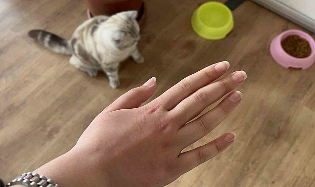 Uzmanı uyardı: Her yıl giderek artıyor