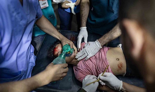 Gazze'de can kaybı 35 bin 562'ye yükseldi