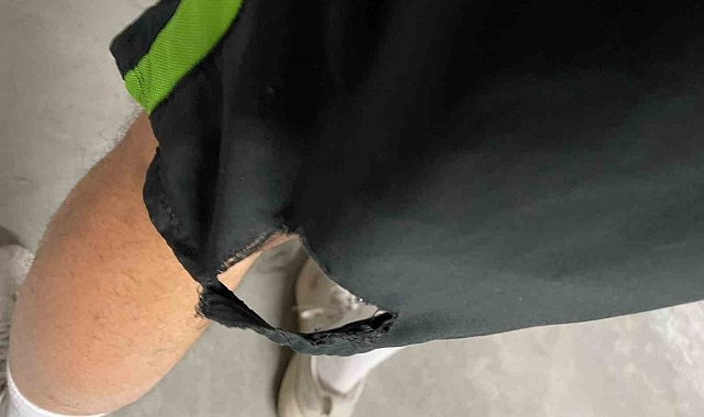 Kağıthane&#039;de yarışmaya hazırlanan sporcuyu başıboş köpek ısırdı