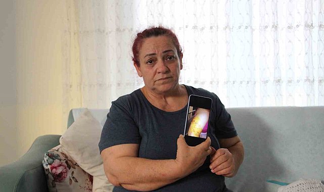 Köpek saldırısında yaşadığı dehşet anlarını unutamayan kadın tek başına sokağa çıkamıyor