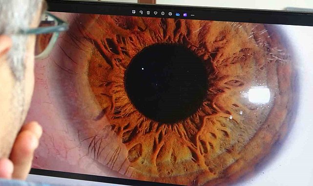 "İris" fotoğrafçılığı ilgi görüyor