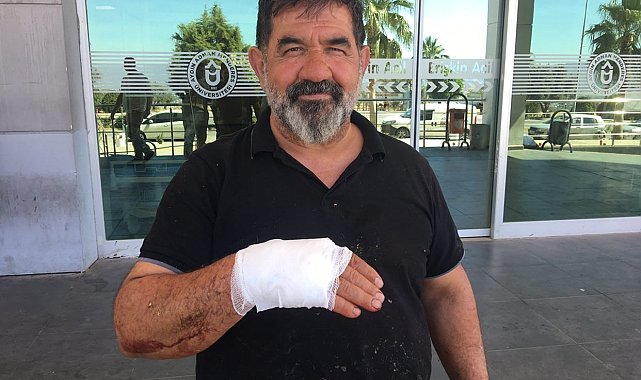 Acemi kasaplar hastanelik oldu