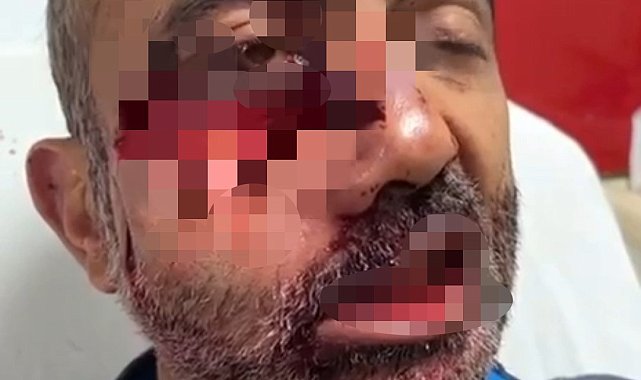 Hakkari'de tarlasına gitti iki ayının saldırısına uğradı