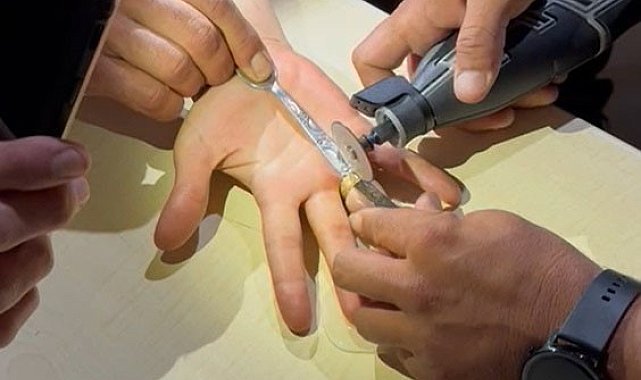Vatandaşın parmağına sıkışan yüzük kesilerek çıkartıldı