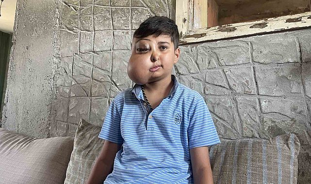 İki farklı yüzü var gibi görünen çocuğun tek isteği iyileşip gülmek