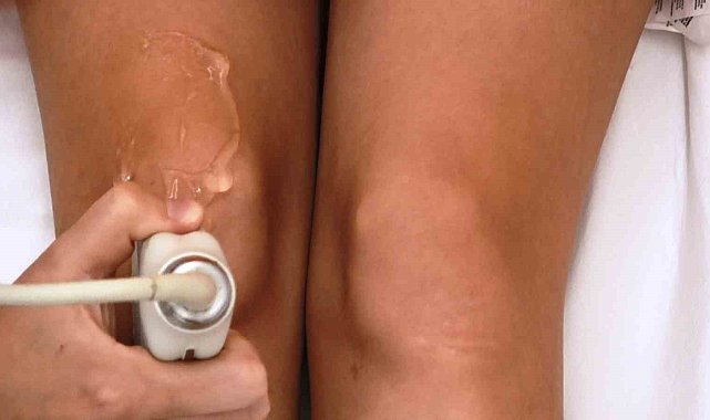 Diz kireçlenmesine bebeklerin göbek kordonuyla tedavi