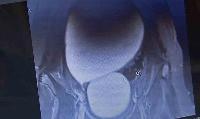 Doktorlar bile gözlerine inanamadı