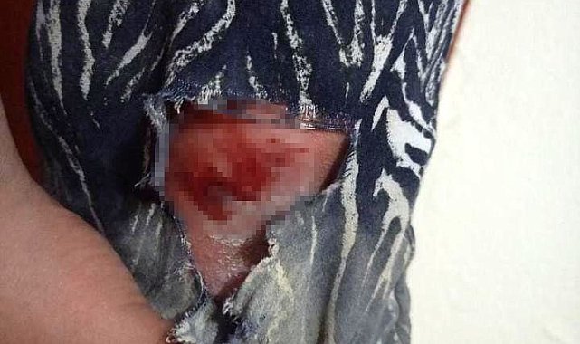 Elazığ'da başıboş köpeklerin kovaladığı şahıs yaralandı