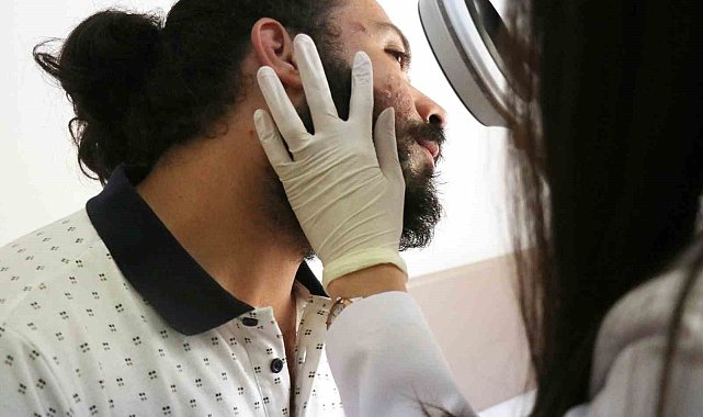 Sıcak havalar cilt hastalıklarını tetikledi: Vatandaş hastanenin yolunu tuttu