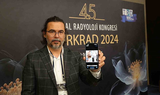 2 aylık Ayaz bebek için amputasyona giden yol girişimsel radyoloji ile kapandı