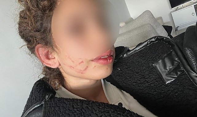 Konya'da 19 yaşındaki kızı darp eden gençten "kendi kendini yaraladı" savunması