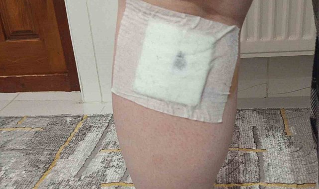 Sokak köpekleri anne ve oğluna saldırdı