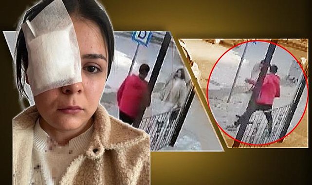 Yolda yürüyen genç kıza yumruk atmış, görüntüler dehşete düşürmüştü! Savunması pes dedirtti: Eski kız arkadaşıma benzettim