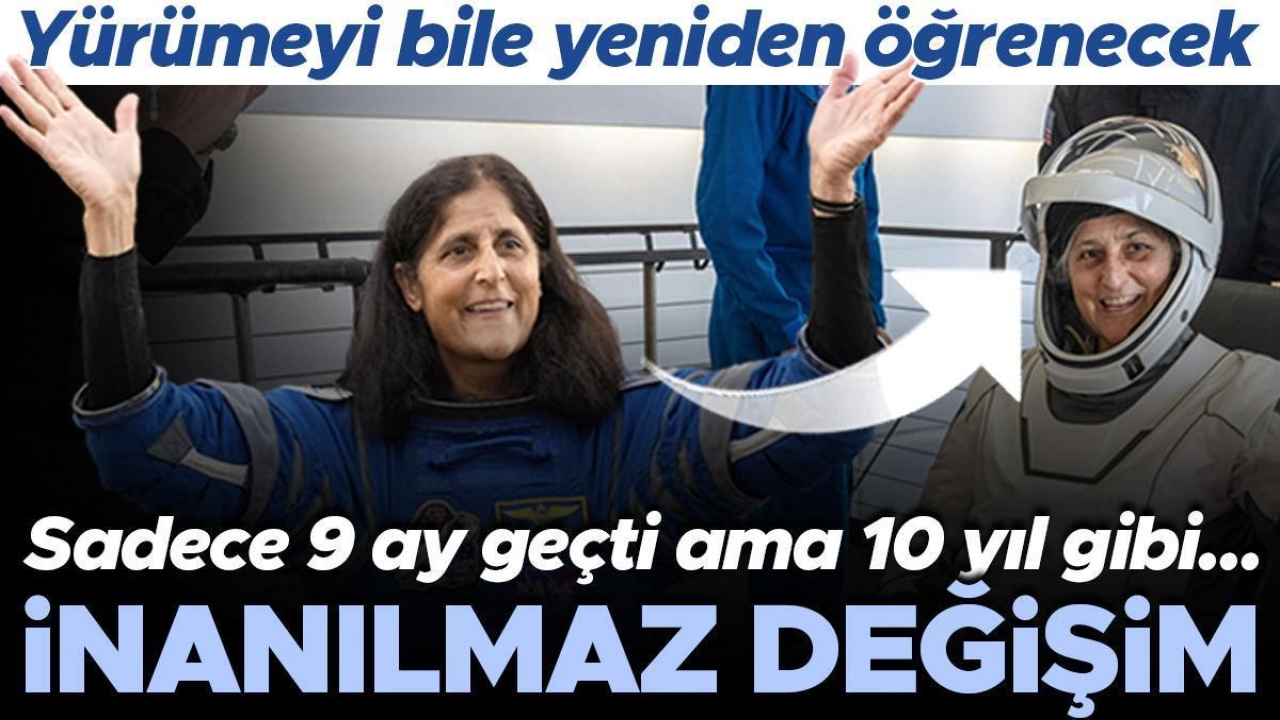 Sadece 9 ay geçti ama 10 yıl gibi... İnanılmaz değişim! Yürümeyi bile yeniden öğrenecek...